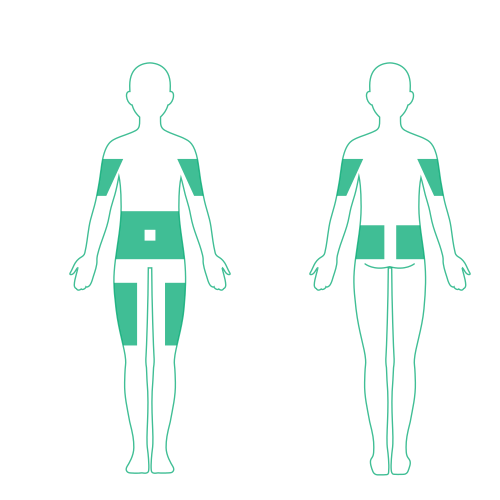 Highlighted parts of the body to consider when selecting infusion sites