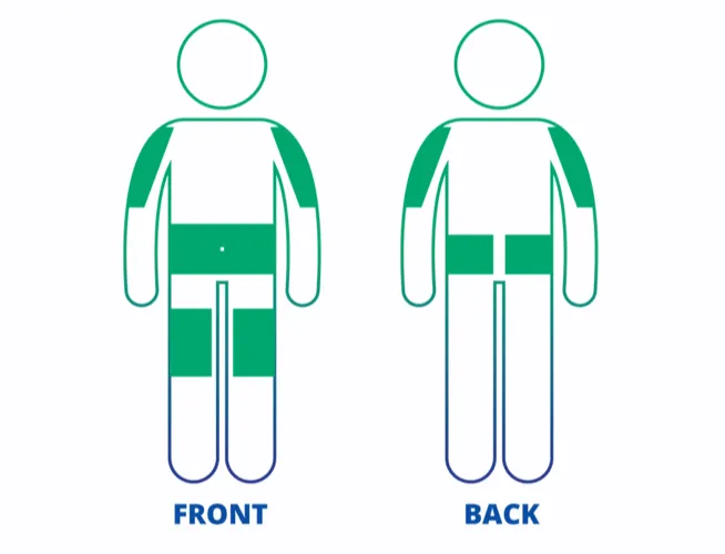 Highlighted parts of the body to consider when selecting infusion sites